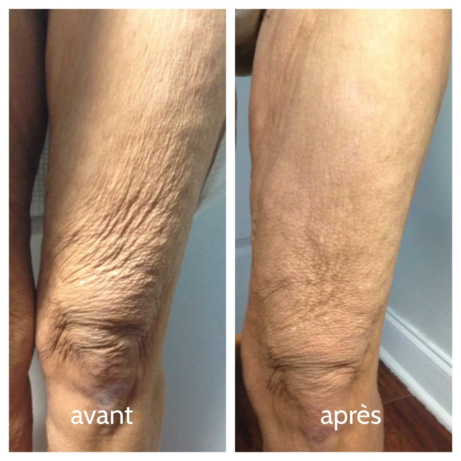 imgi_78_avant.webp